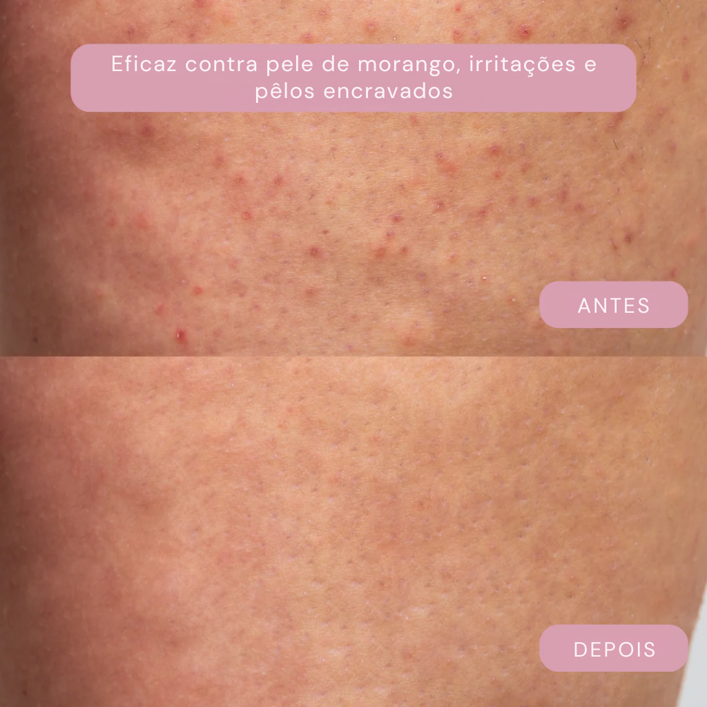 Glisse Pro Premium Damenrasierer