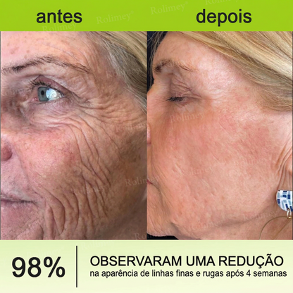 LiftingPro – Sérum Rejuvenescedor Efeito Botox